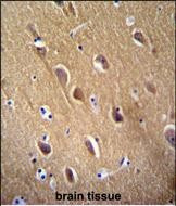 NSE Antibody in Immunohistochemistry (Paraffin) (IHC (P))