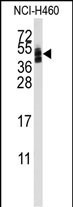 CAR Antibody in Western Blot (WB)