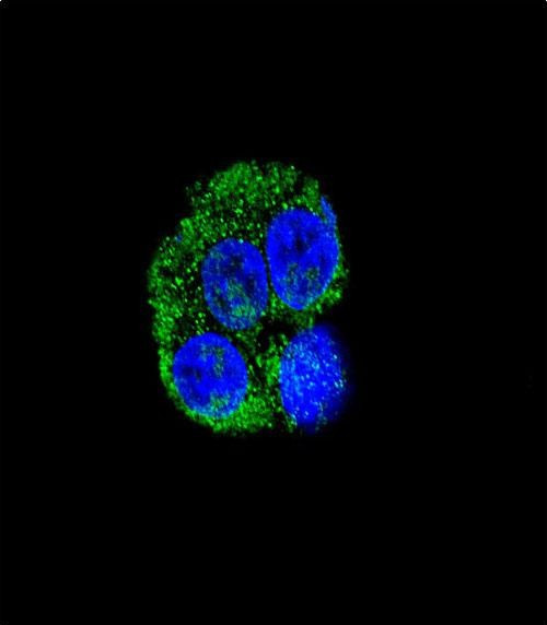 CD36 Antibody in Immunocytochemistry (ICC/IF)