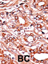 Phospho-c-Abl (Tyr134) Antibody in Immunohistochemistry (Paraffin) (IHC (P))