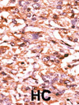 Phospho-Cdc25B (Ser187) Antibody in Immunohistochemistry (Paraffin) (IHC (P))