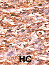 Phospho-VEGF Receptor 2 (Tyr996) Antibody in Immunohistochemistry (Paraffin) (IHC (P))