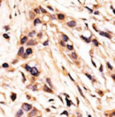 Phospho-Rb (Ser608) Antibody in Immunohistochemistry (Paraffin) (IHC (P))