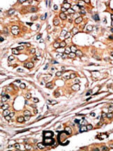 Phospho-Rb (Ser780) Antibody in Immunohistochemistry (Paraffin) (IHC (P))