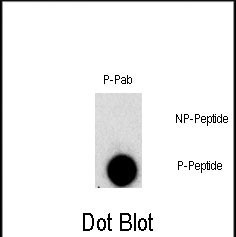 Phospho-FGFR1 (Tyr307) Antibody in Dot Blot (DB)