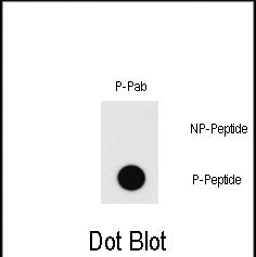 Phospho-MEF2C (Thr20) Antibody in Dot Blot (DB)