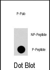 Phospho-RGS19 (Ser24) Antibody in Dot Blot (DB)