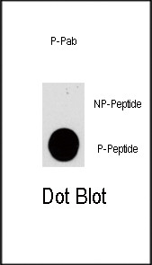 Phospho-PIK3CG (Ser1100) Antibody in Dot Blot (DB)