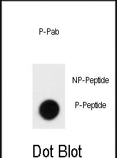 Phospho-CD150 (Tyr281) Antibody in Dot Blot (DB)