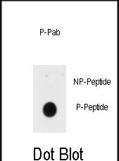 Phospho-INSR (Tyr1185) Antibody in Dot Blot (DB)