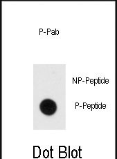 Phospho-MBP (Tyr203) Antibody in Dot Blot (DB)