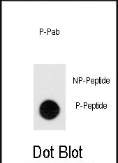 Phospho-TEK (Tyr1113) Antibody in Dot Blot (DB)