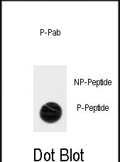 Phospho-ACK1 (Tyr518) Antibody in Dot Blot (DB)