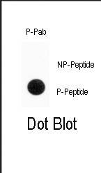 Phospho-ENT1 (Ser254) Antibody in Dot Blot (DB)