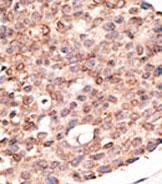 CRY2 Antibody in Immunohistochemistry (Paraffin) (IHC (P))