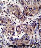 MAGEA3 Antibody in Immunohistochemistry (Paraffin) (IHC (P))