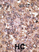 SIRT5 Antibody in Immunohistochemistry (Paraffin) (IHC (P))