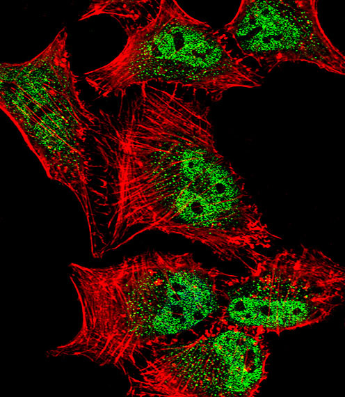 MEF2C Antibody in Immunocytochemistry (ICC/IF)