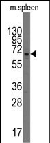 PARP3 Antibody in Western Blot (WB)