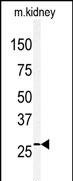 Claudin 2 Antibody in Western Blot (WB)