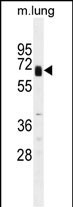 Glypican 3 Antibody in Western Blot (WB)