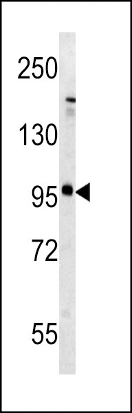 mGluR5 Antibody in Western Blot (WB)