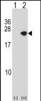 alpha Synuclein Antibody in Western Blot (WB)