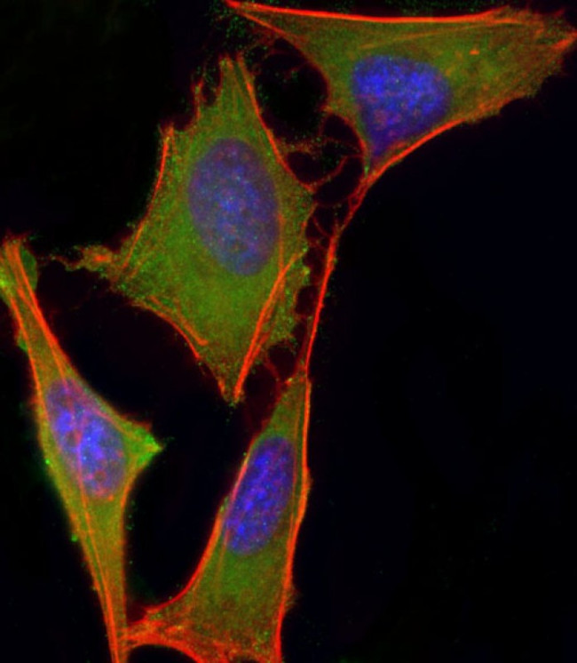 VHL Antibody in Immunocytochemistry (ICC/IF)