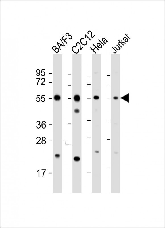 Caspase 8 Antibody in Western Blot (WB)