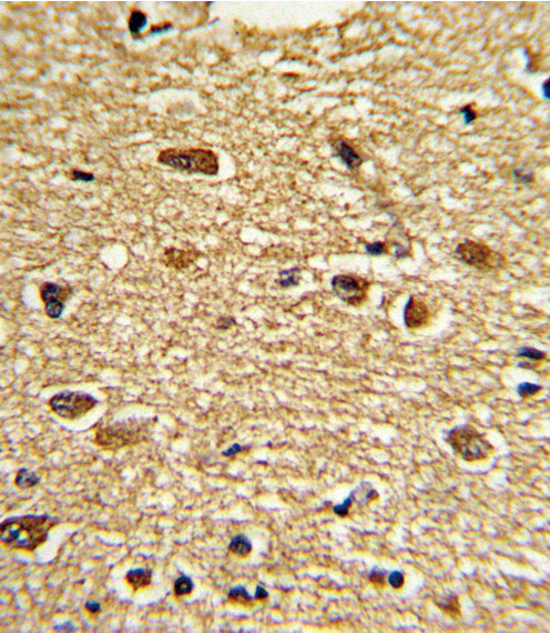 ETV4 Antibody in Immunohistochemistry (Paraffin) (IHC (P))