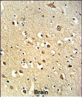 OGT Antibody in Immunohistochemistry (Paraffin) (IHC (P))