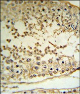 PRAME Antibody in Immunohistochemistry (Paraffin) (IHC (P))