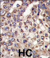 MTMR4 Antibody in Immunohistochemistry (Paraffin) (IHC (P))