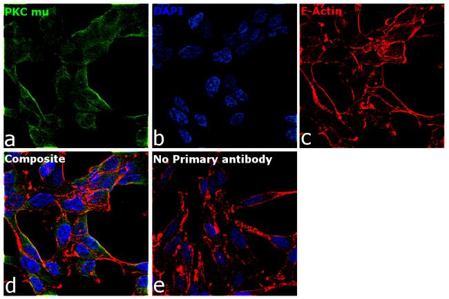 PKC mu Antibody in Immunocytochemistry (ICC/IF)