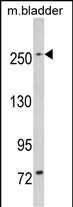 LRRK1 Antibody in Western Blot (WB)