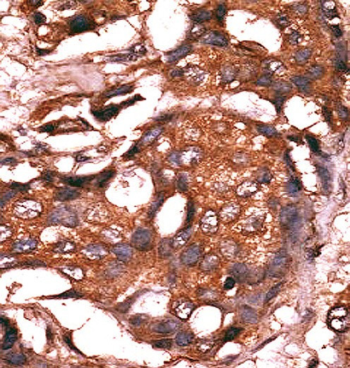 GUCY1A3 Antibody in Immunohistochemistry (Paraffin) (IHC (P))