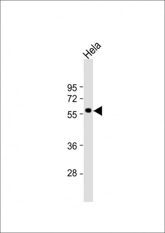 MKNK2 Antibody in Western Blot (WB)