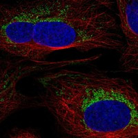 SLC6A17 Antibody in Immunocytochemistry (ICC/IF)