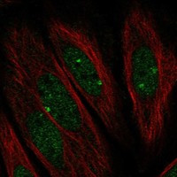 PARP3 Antibody in Immunocytochemistry (ICC/IF)