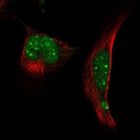 RNF4 Antibody in Immunocytochemistry (ICC/IF)