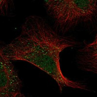 ADAMTS13 Antibody in Immunocytochemistry (ICC/IF)