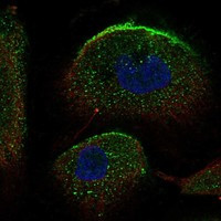 SLC34A2 Antibody in Immunocytochemistry (ICC/IF)