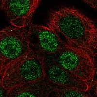 ANP32B Antibody in Immunocytochemistry (ICC/IF)