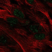 MYOCD Antibody in Immunocytochemistry (ICC/IF)