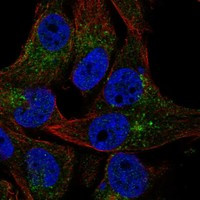 VAC14 Antibody in Immunocytochemistry (ICC/IF)