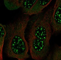 HDBP2 Antibody in Immunocytochemistry (ICC/IF)