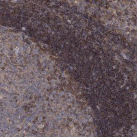 BLOC1S3 Antibody in Immunohistochemistry (Paraffin) (IHC (P))