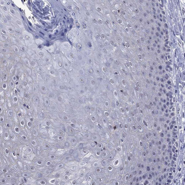 ApoA2 Antibody in Immunohistochemistry (Paraffin) (IHC (P))