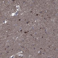 SLC44A1 Antibody in Immunohistochemistry (Paraffin) (IHC (P))