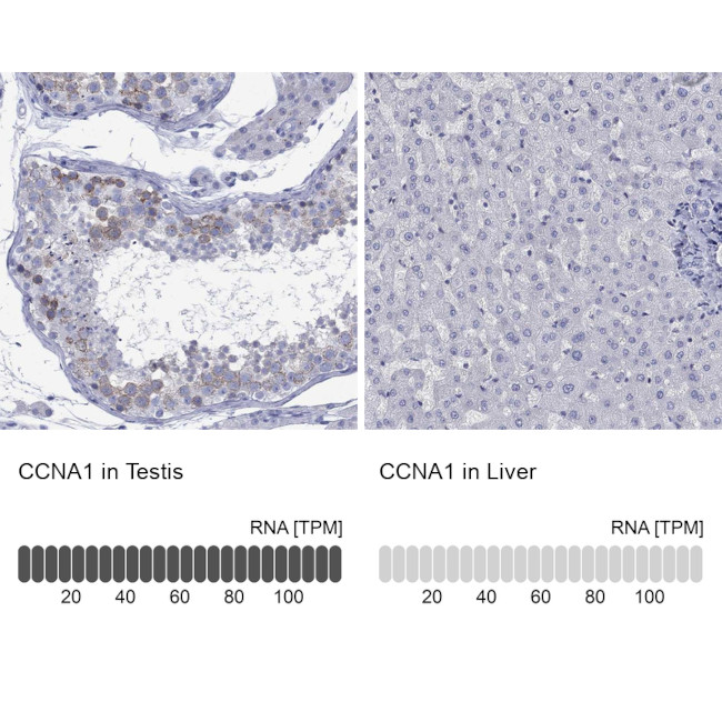 Cyclin A1 Antibody in Immunohistochemistry (Paraffin) (IHC (P))